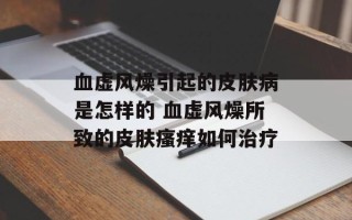 血虚风燥引起的皮肤病是怎样的 血虚风燥所致的皮肤瘙痒如何治疗