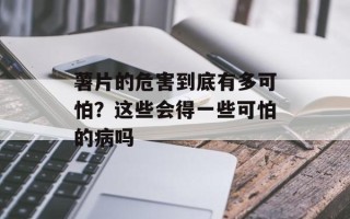 薯片的危害到底有多可怕？这些会得一些可怕的病吗