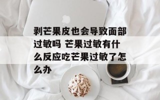 剥芒果皮也会导致面部过敏吗 芒果过敏有什么反应吃芒果过敏了怎么办